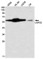USP22 Rabbit mAb ABZ1749