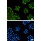 Transcription Termination Factor 2/TTF2 Rabbit mAb ABZ1750