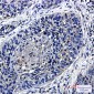 Transcription Termination Factor 2/TTF2 Rabbit mAb ABZ1750