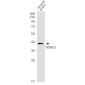 NDRG2 Rabbit mAb ABZ1754