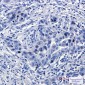 TPX2 Rabbit mAb ABZ1756