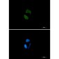 Argonaute 2 Rabbit mAb ABZ1760