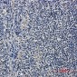 HDAC9 Rabbit mAb ABZ1761