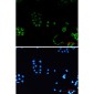 PACSIN3 Rabbit mAb ABZ1762