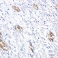 PACSIN3 Rabbit mAb ABZ1762