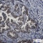 APPL Rabbit mAb ABZ1763