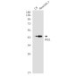 ING1 Rabbit mAb ABZ1764