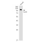 Sall4 Rabbit mAb ABZ1767