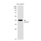 DAPK2 Rabbit mAb ABZ1768