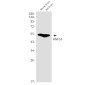 RNF14 Rabbit mAb ABZ1777