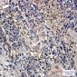 DcR2 Rabbit mAb ABZ1779
