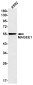 MAGEC2 Rabbit mAb ABZ1781