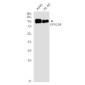 EPS15R Rabbit mAb ABZ1783