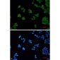 PEN2 Rabbit mAb ABZ1794
