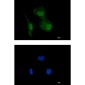 HIF1AN/FIH-1 Rabbit mAb ABZ1800