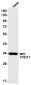 TREX1 Rabbit mAb ABZ1805