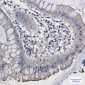 DISC1 Rabbit mAb ABZ1808