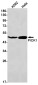 PICK1 Rabbit mAb ABZ1810