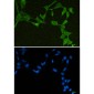 DDX21 Rabbit mAb ABZ1812
