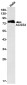 ACSS2 Rabbit mAb ABZ1814