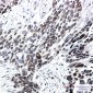 TCF4 Rabbit mAb ABZ1817