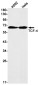 TCF4 Rabbit mAb ABZ1817