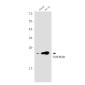 TMEM9B Rabbit mAb ABZ1820