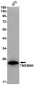 TMEM9B Rabbit mAb ABZ1820