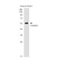 TXNRD2 Rabbit mAb ABZ1824