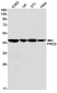 PREB Rabbit mAb ABZ1825