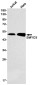 SMYD3 Rabbit mAb ABZ1833