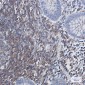 PHD3 Rabbit mAb ABZ1834