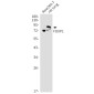 FOXP1 Rabbit mAb ABZ1840