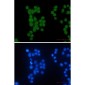 HIPK2 Rabbit mAb ABZ1842