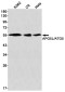 APG5L/ATG5 Rabbit mAb ABZ1845