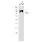 Ctip1/BCL-11A Rabbit mAb ABZ1846
