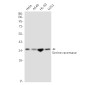 Serine Racemase Rabbit mAb ABZ1849