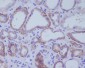 ACE2 Rabbit mAb ABZ1862