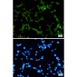 ORP1 Rabbit mAb ABZ1866