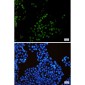 KIFC1 Rabbit mAb ABZ1868