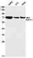 KIFC1 Rabbit mAb ABZ1868