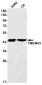 Transmembrane Protein 43 Rabbit mAb ABZ1871