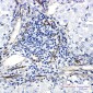 ORAI3 Rabbit mAb ABZ1873