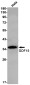 GDF15 Rabbit mAb ABZ1875