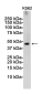 TSG101 Rabbit mAb ABZ1877