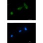 TSG101 Rabbit mAb ABZ1878