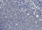 TSG101 Rabbit mAb ABZ1878