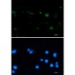 Aconitase 2 Rabbit mAb ABZ1879