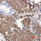 Aconitase 2 Rabbit mAb ABZ1879