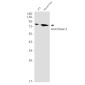 Aconitase 2 Rabbit mAb ABZ1879
